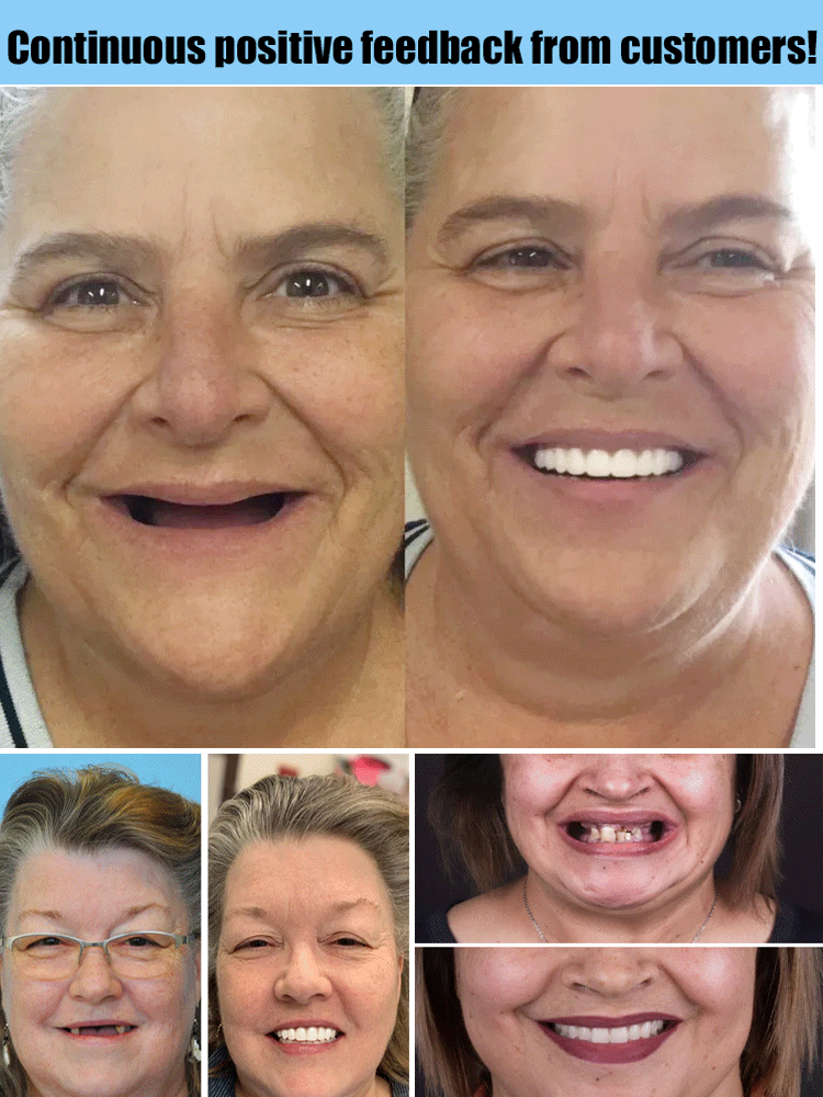 🦷🔥This week's special offer🔥Full Denture Set
